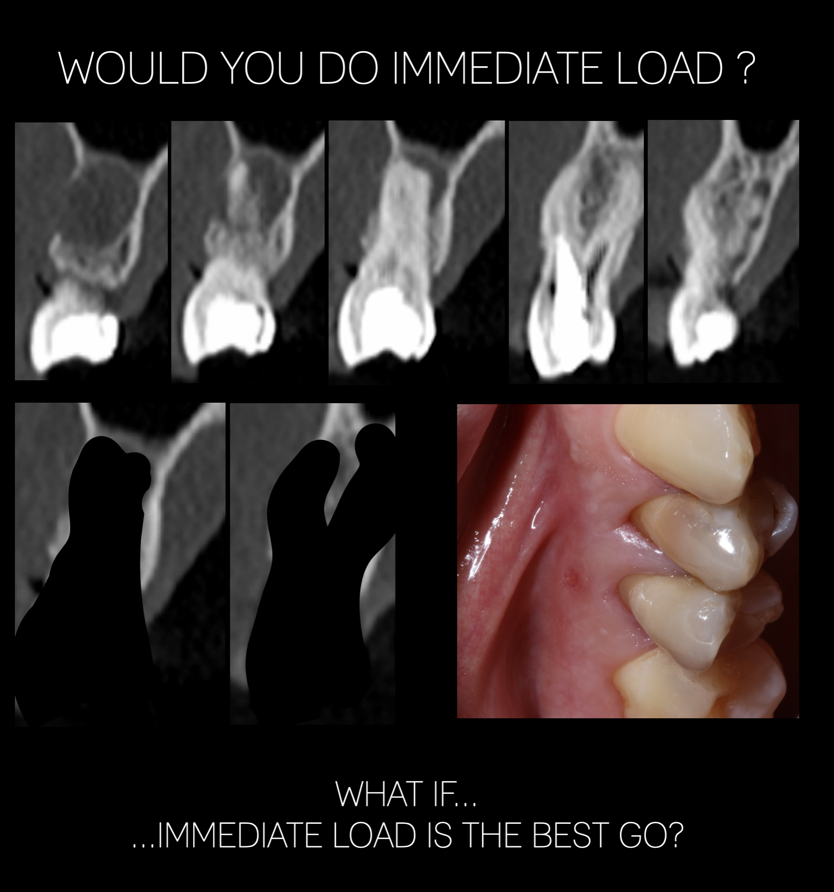 COVER 1 JOÃO SILVA BB.png