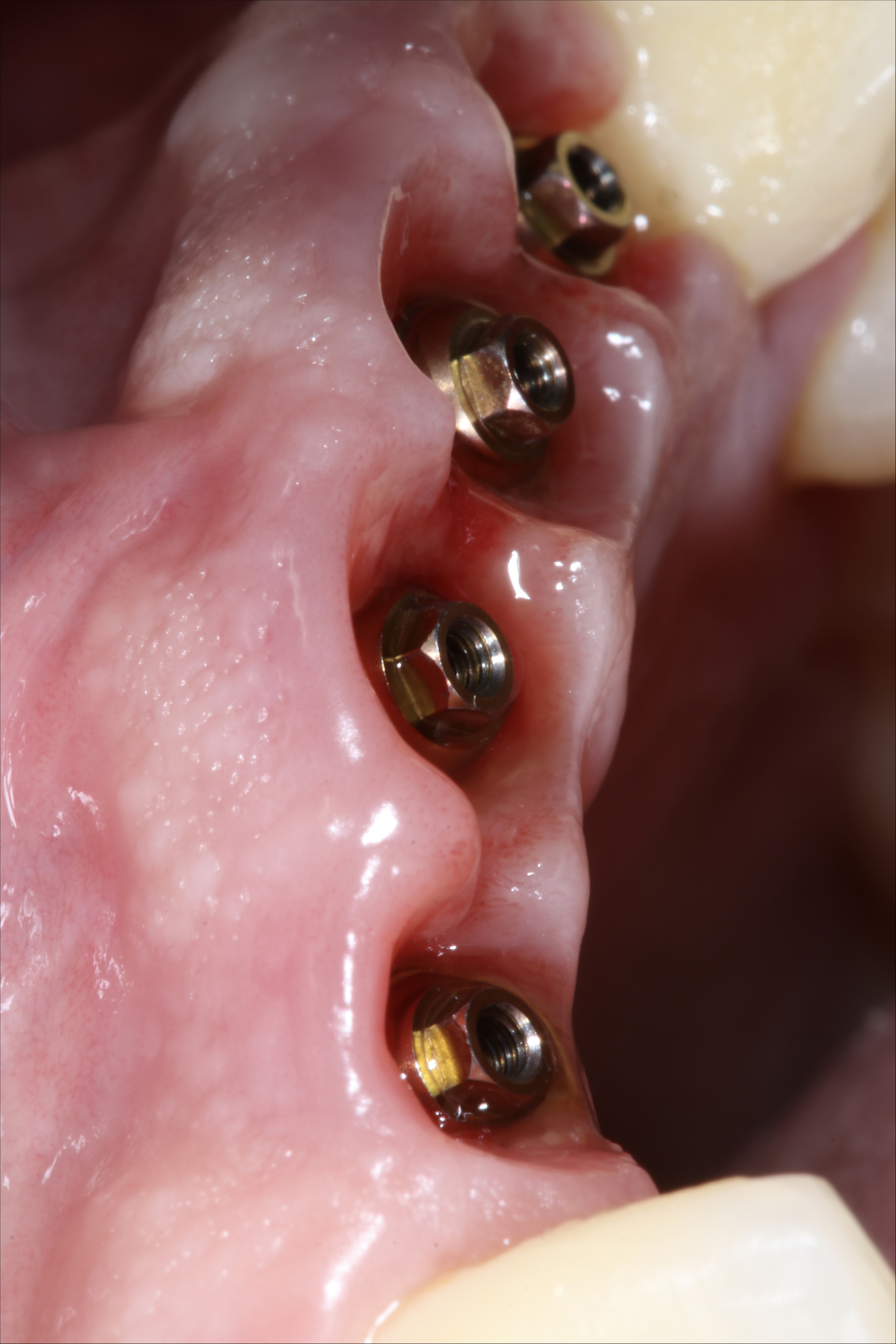 Fig 8  trophy photo VERTICAL.JPG