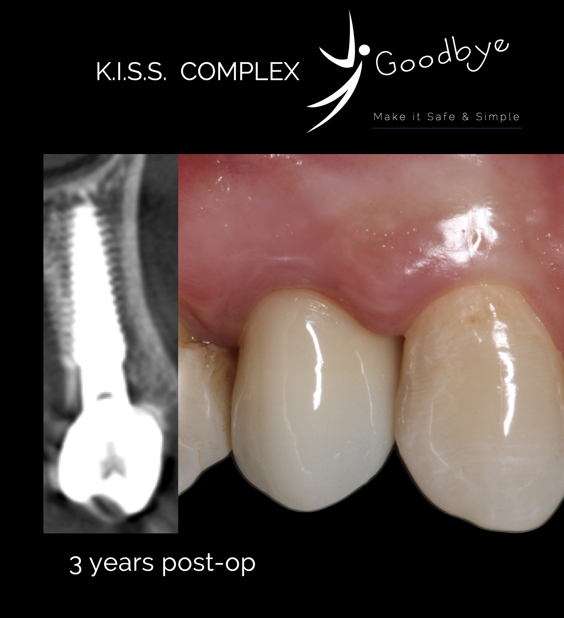 Graça Sofia cover.png