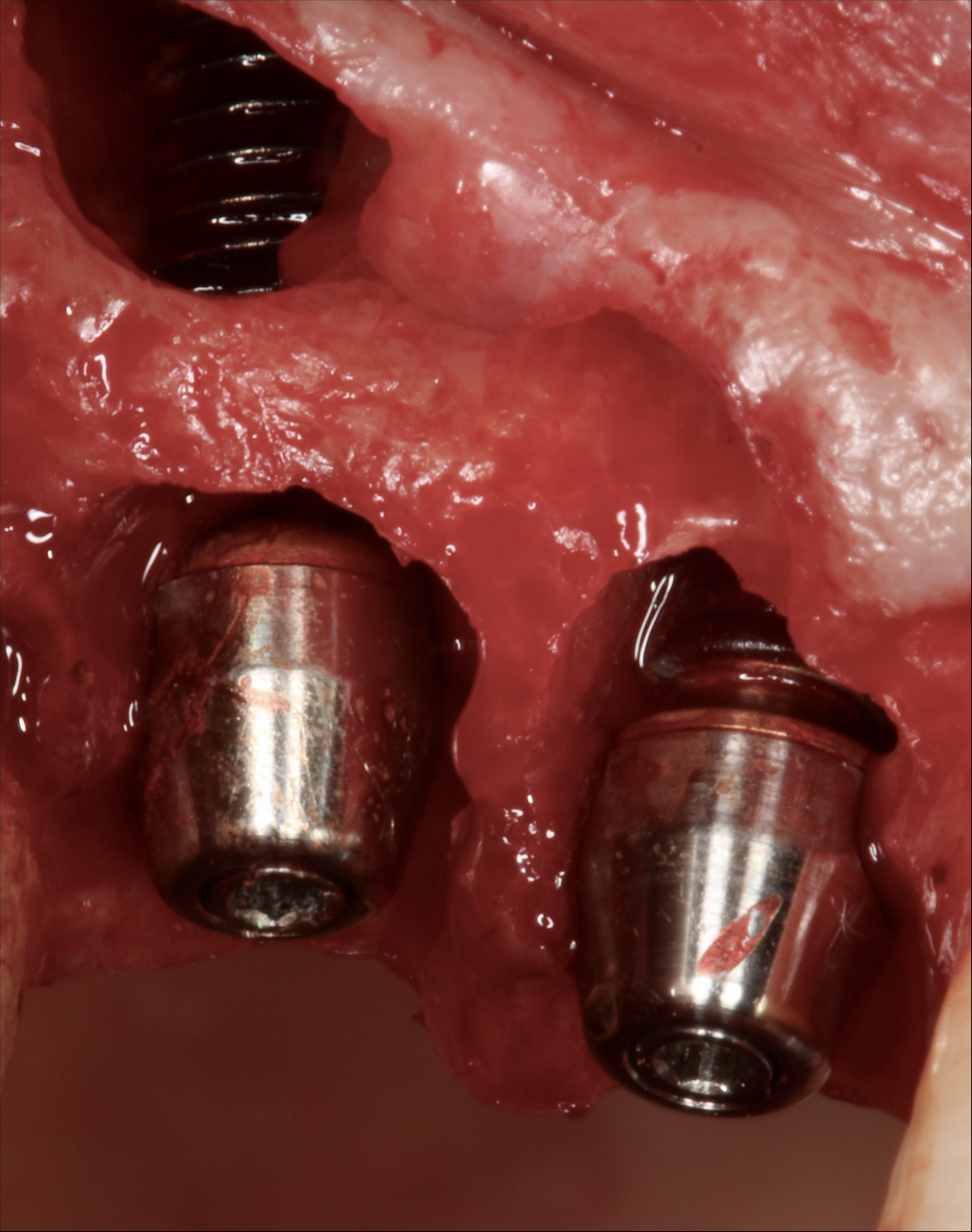 a 0 João Castro REVERSE PET (15).JPG