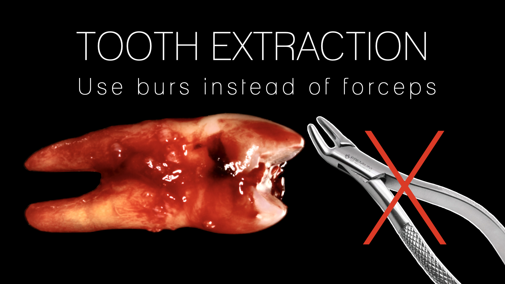 ‎REVERSE PET The New TOOTH EXTRACTION cover.‎001.jpeg