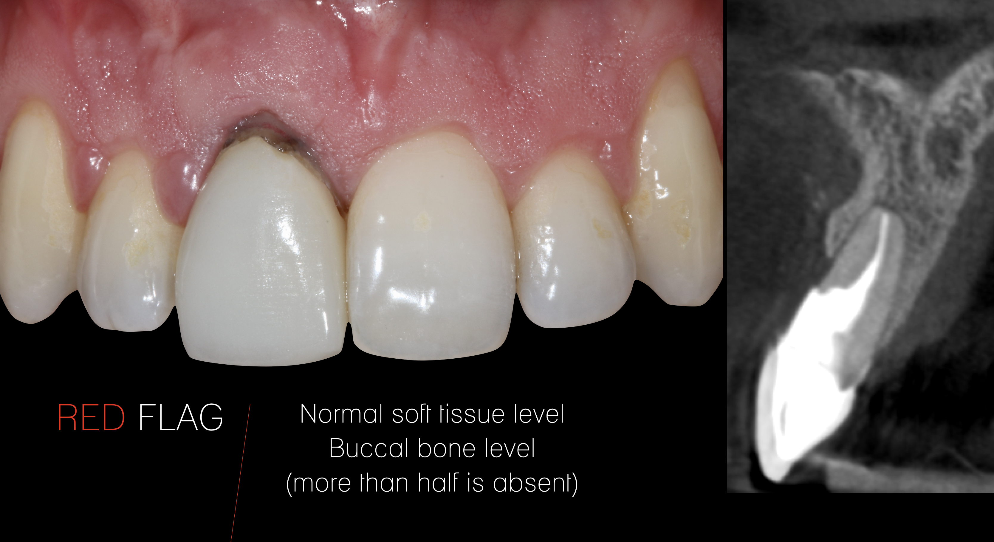 Duarte Nuno socket 2b.png