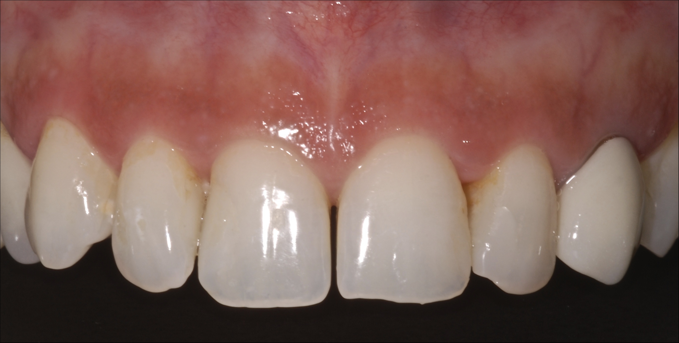 MargaridaMendes 17022009 (8).jpg