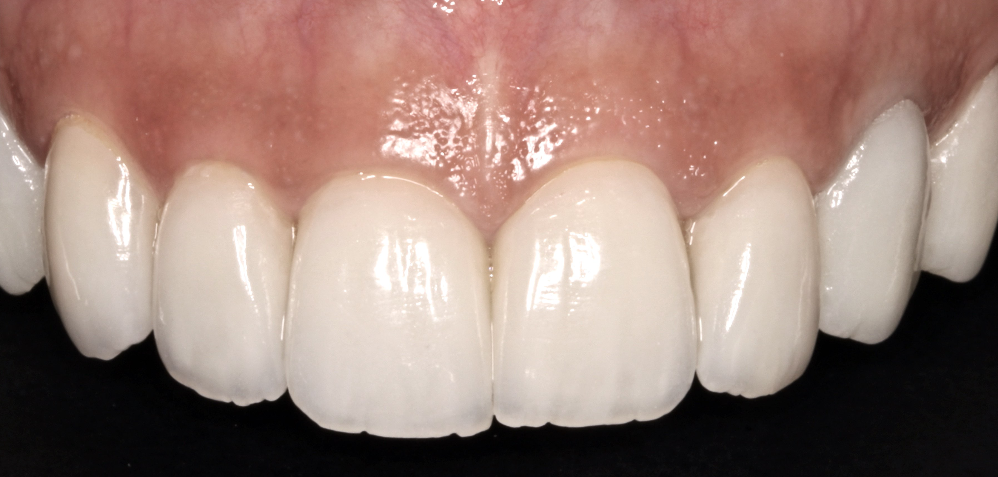 Screen Shot 2021-06-10 at 08.36.12.png