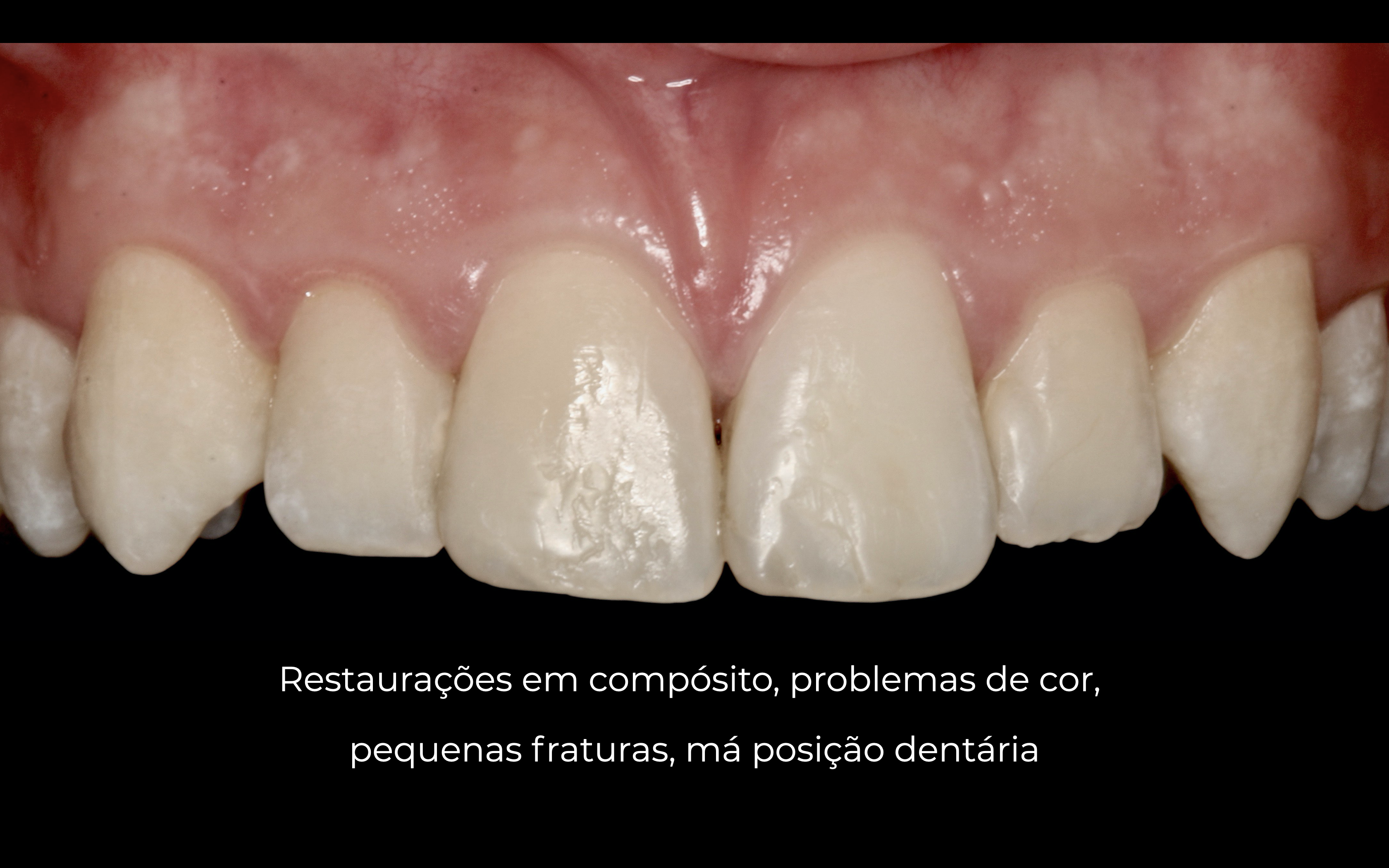 Artur inicial dentes.png