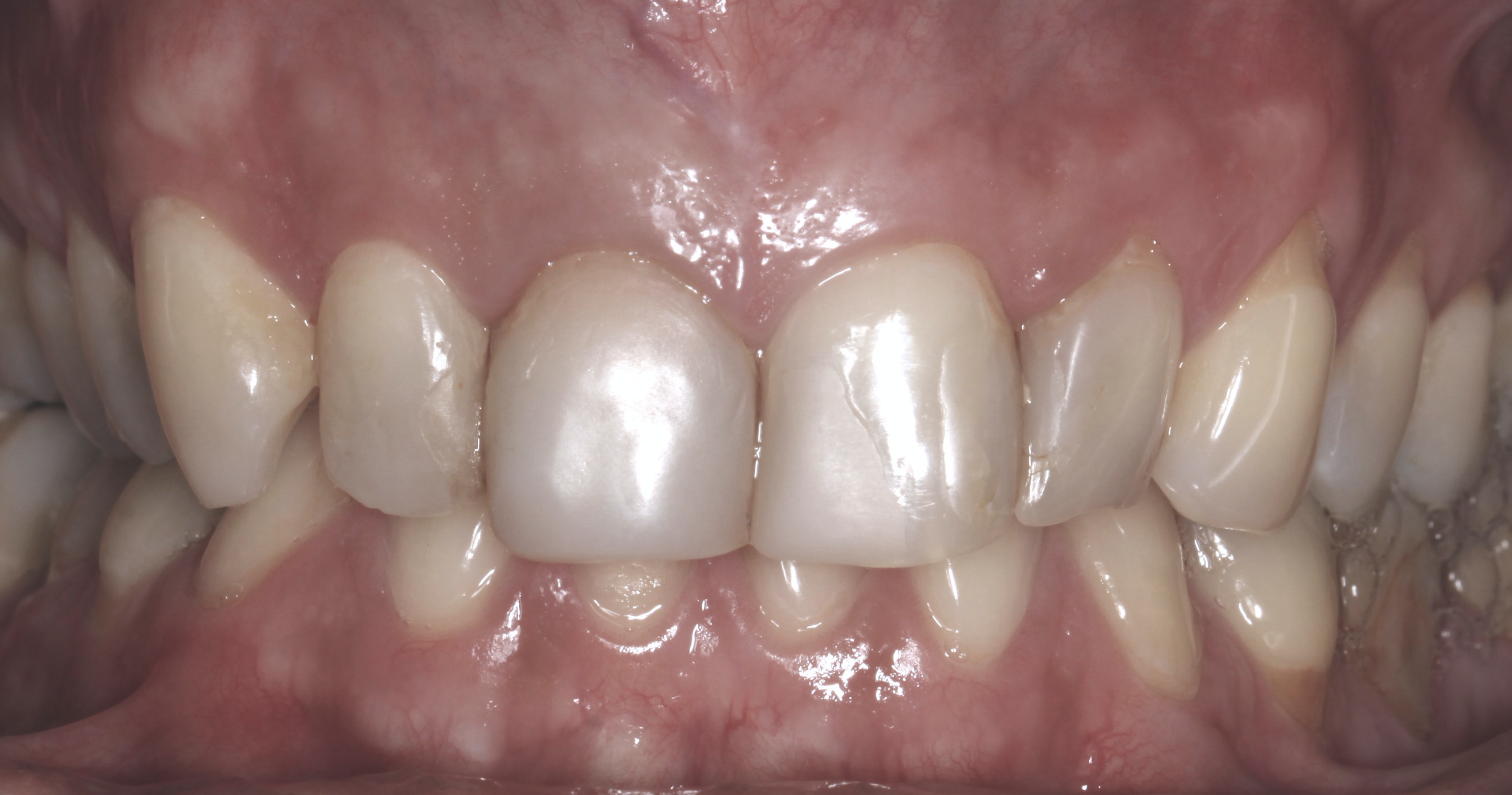 Screen Shot 2020-06-22 at 11.28.42.png