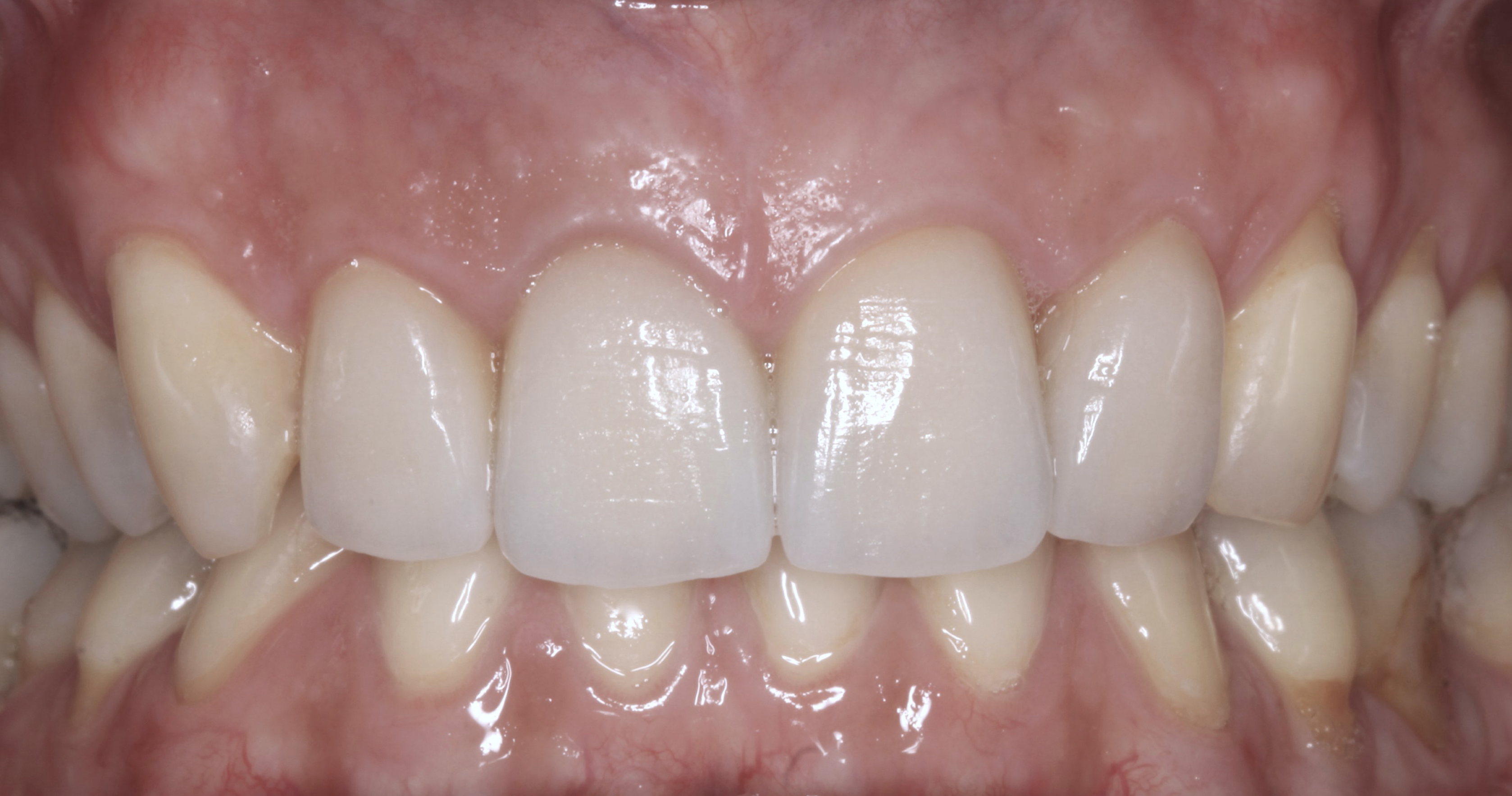 Screen Shot 2020-06-22 at 11.28.56.png