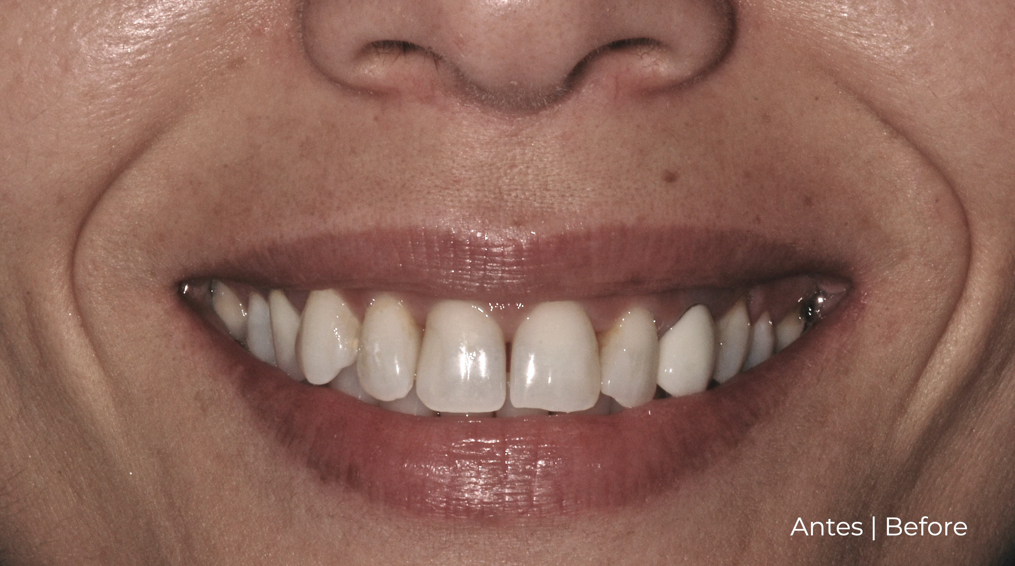 Margarida face antes.png