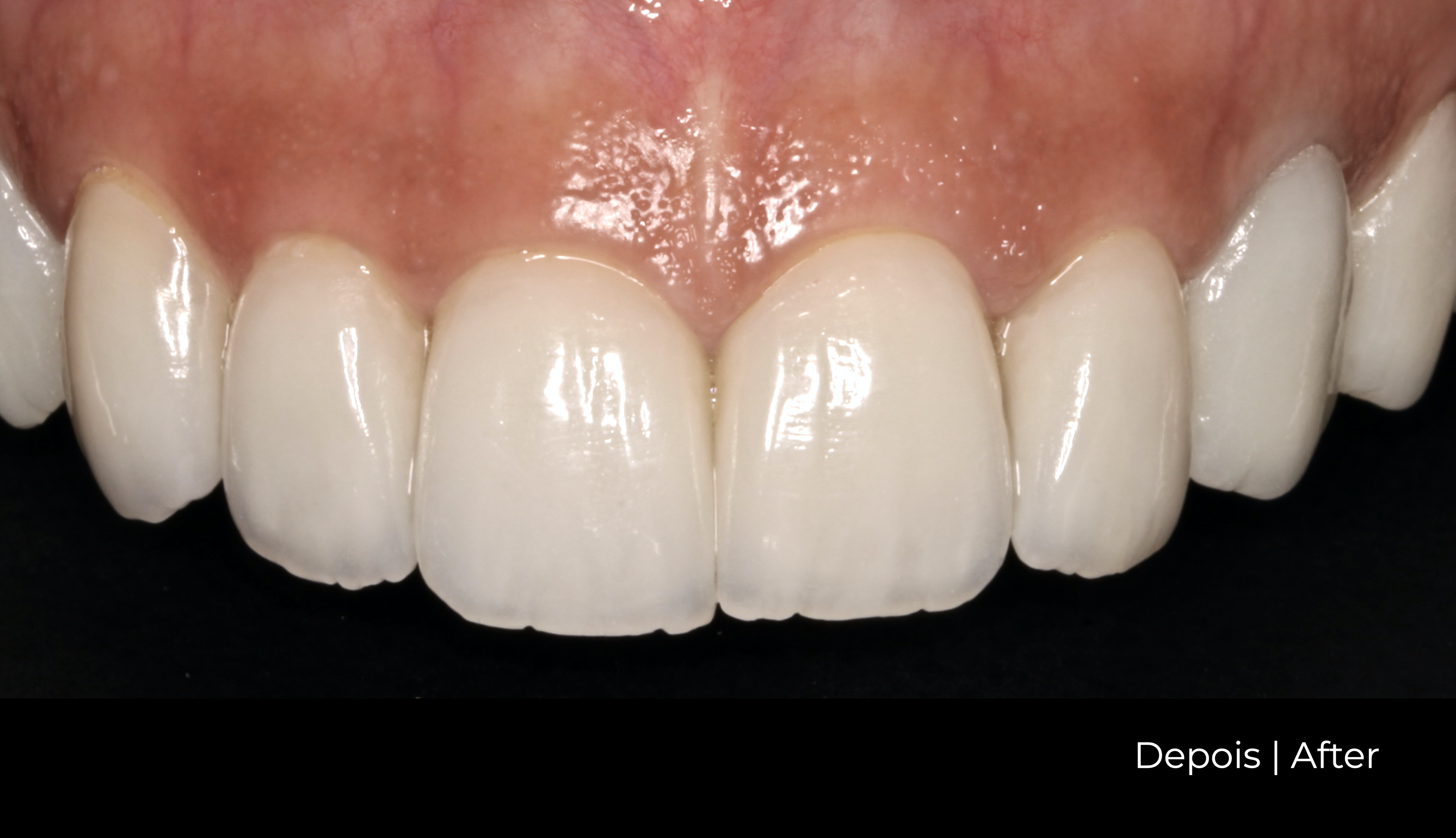 Margarida dentes depois.png