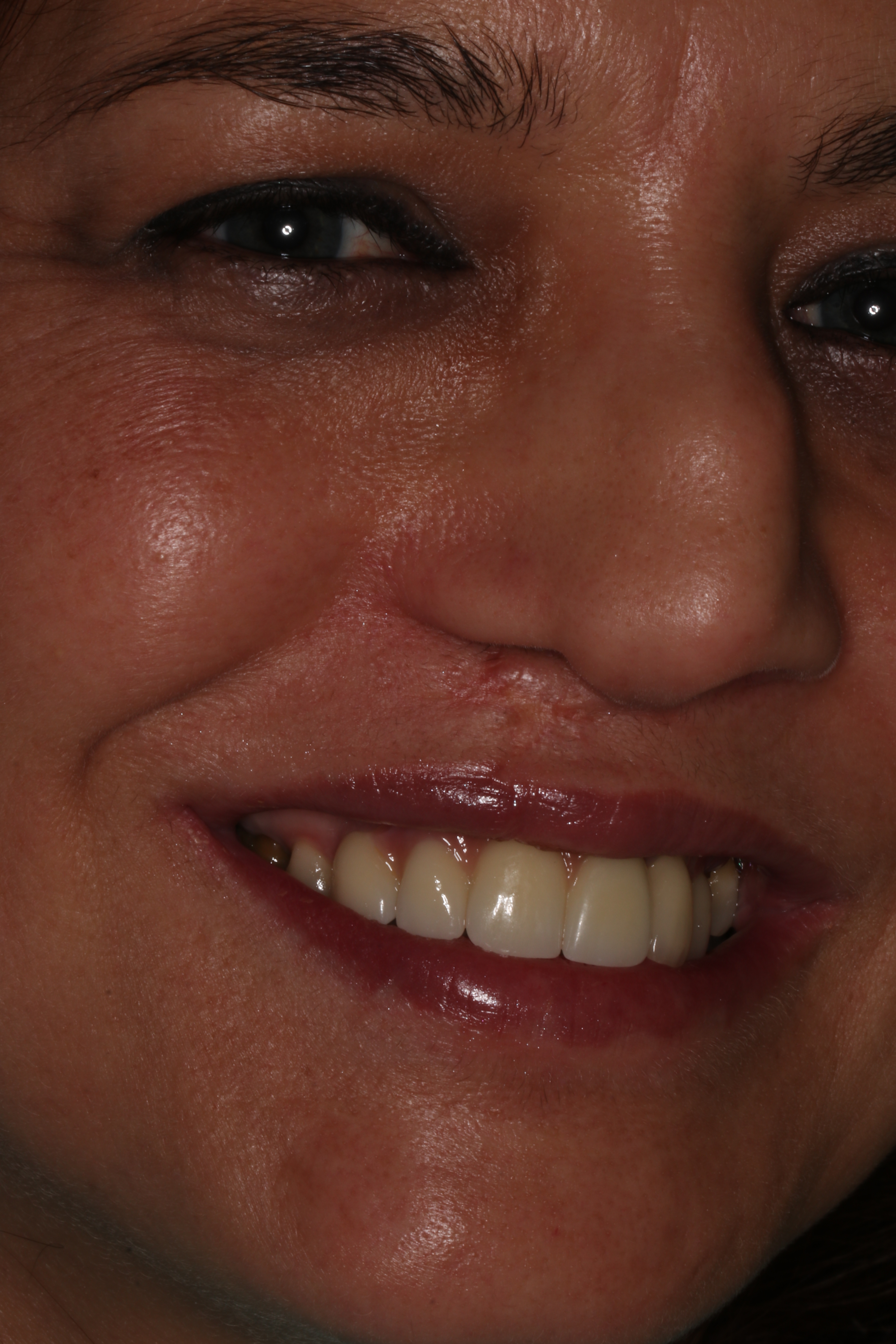 anovais1anoemeio18-20190318174159.JPG