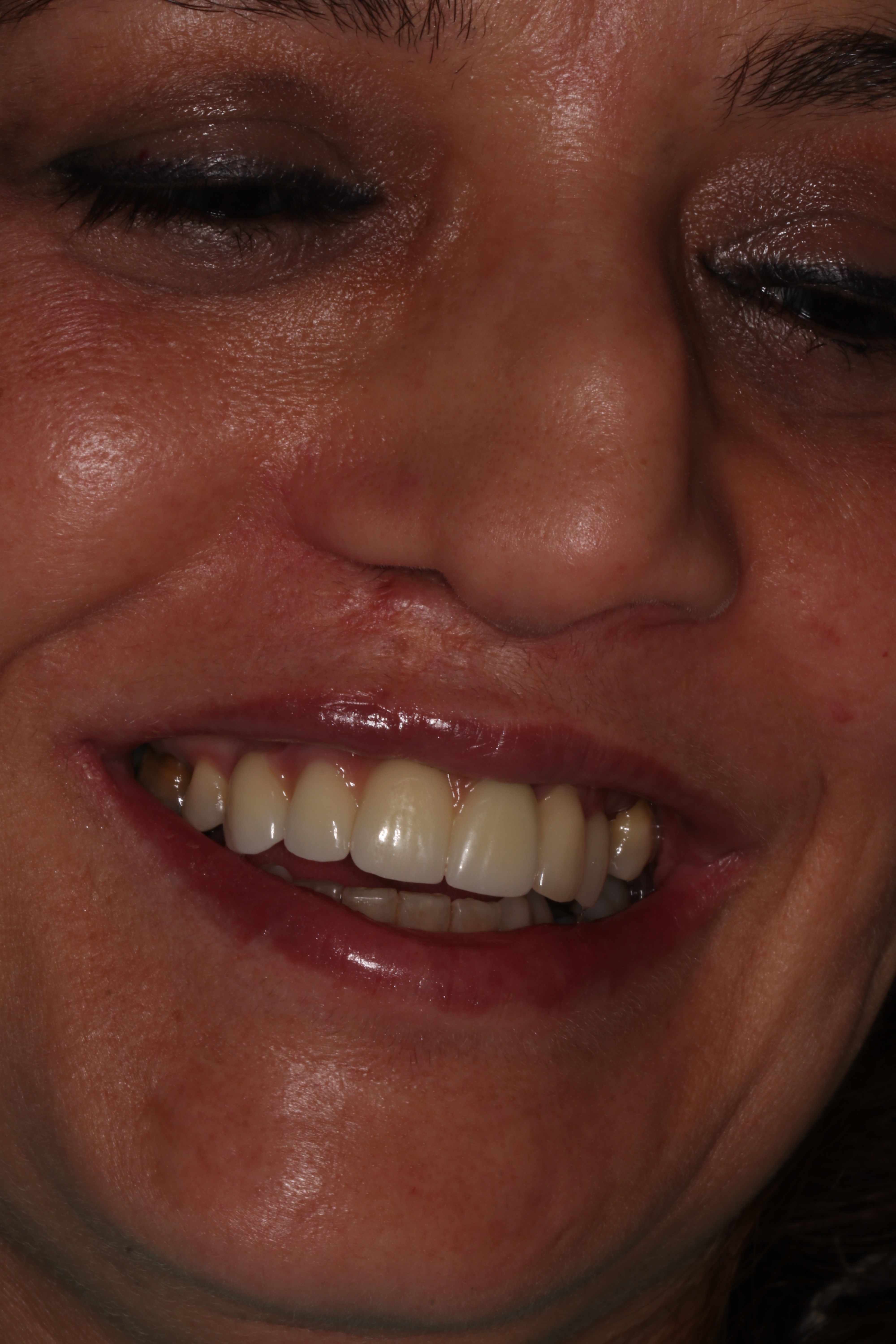 anovais1anoemeio19-20190318173620.JPG