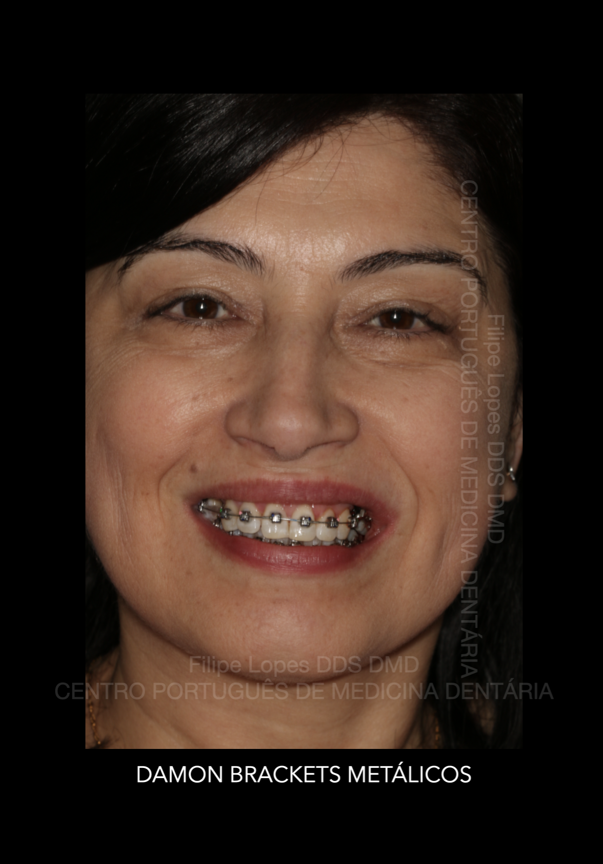 Screenshot 2022-09-26 at 18.22.12.png