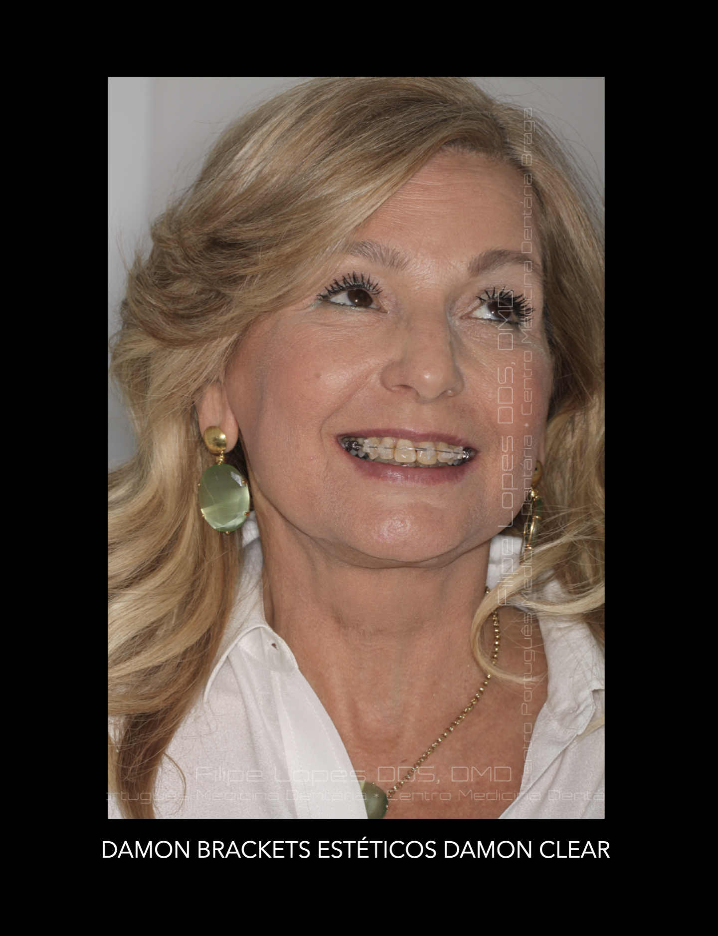 Screenshot 2022-09-26 at 18.22.19.png