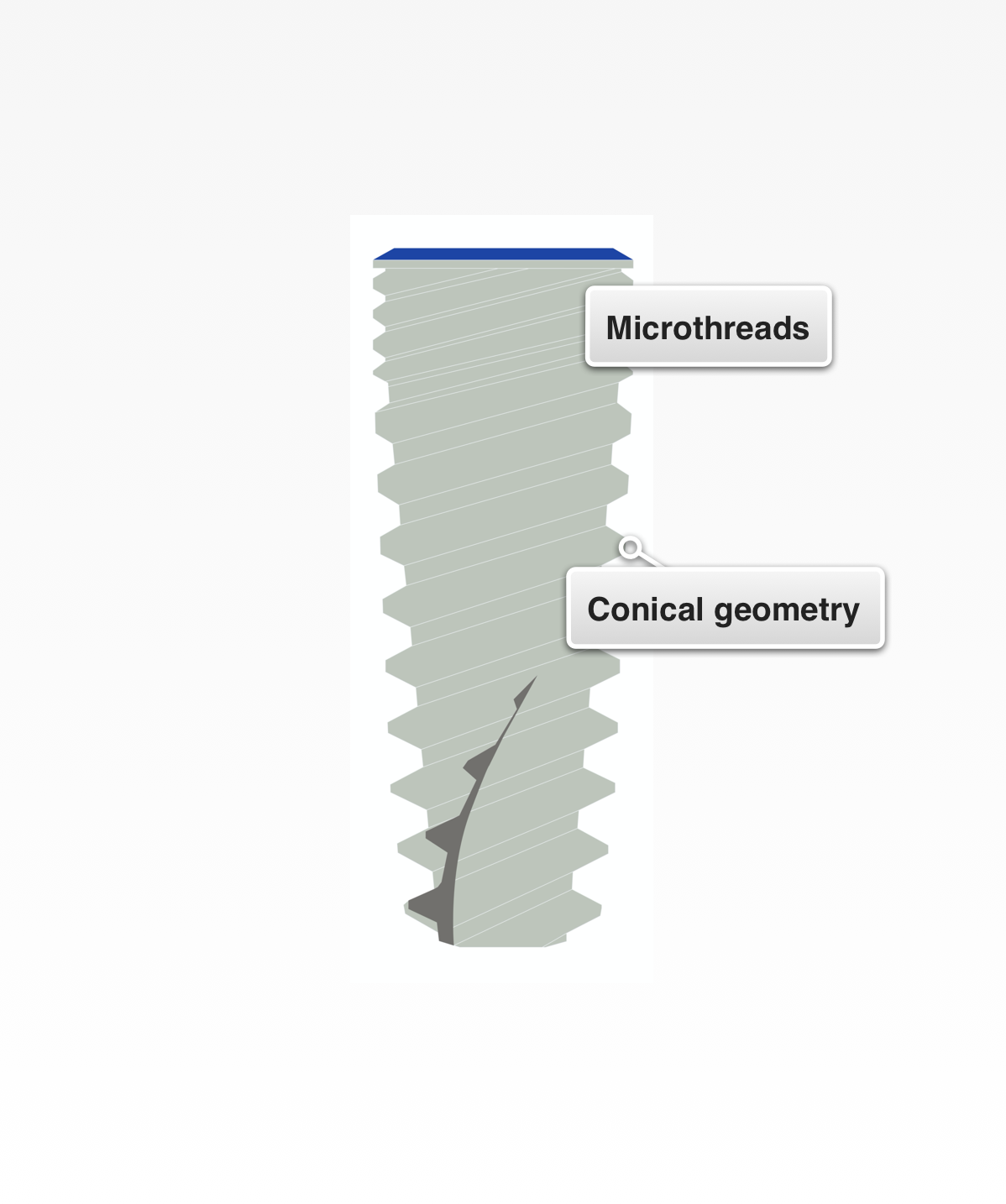 implant design.png