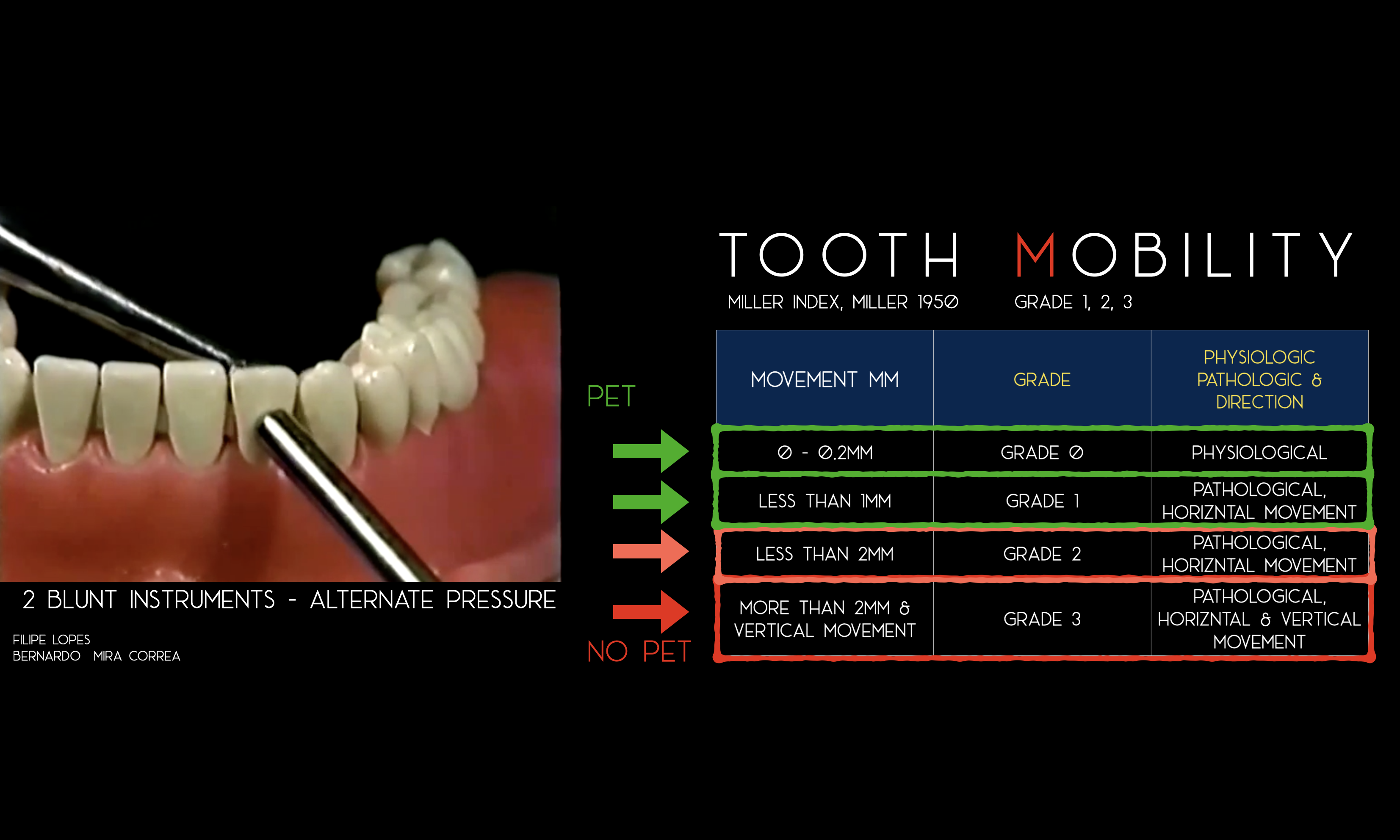 tooth mobility Filipe Lopes Bernardo M Correa.png