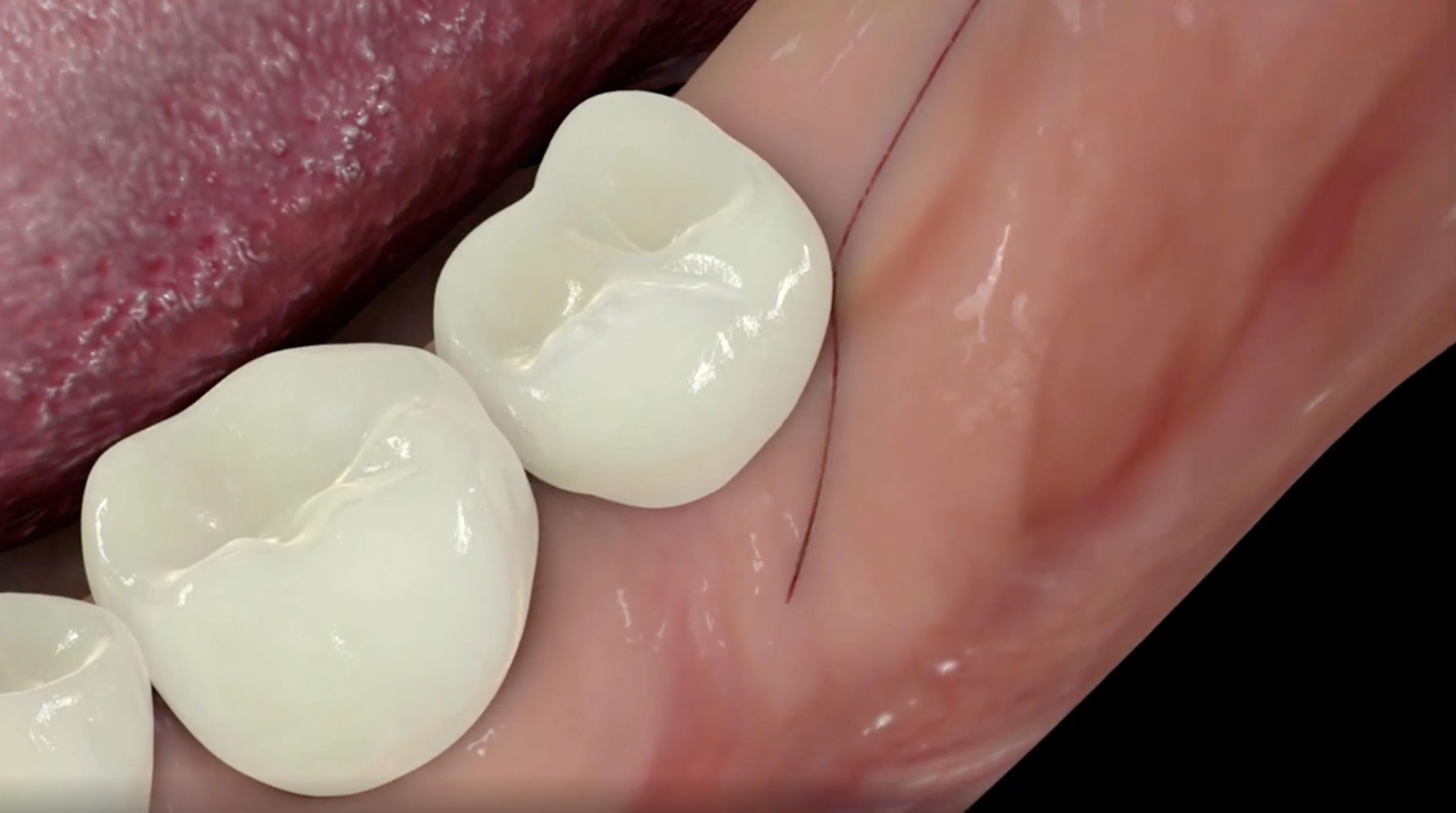 Screen Shot 2021-09-25 at 10.14.03.png