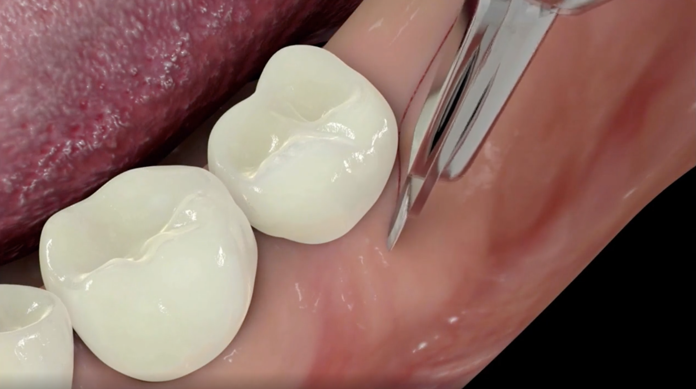 Screen Shot 2021-09-25 at 10.13.47.png