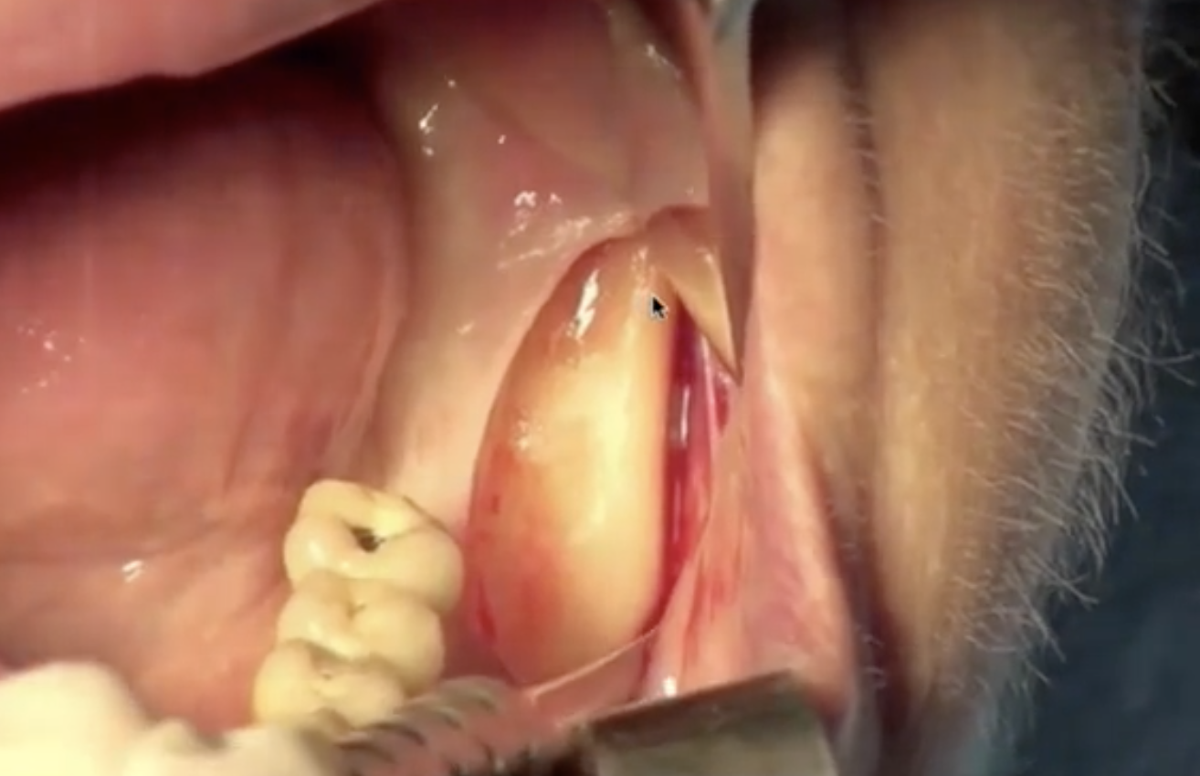 Screen Shot 2021-09-25 at 09.01.24.png