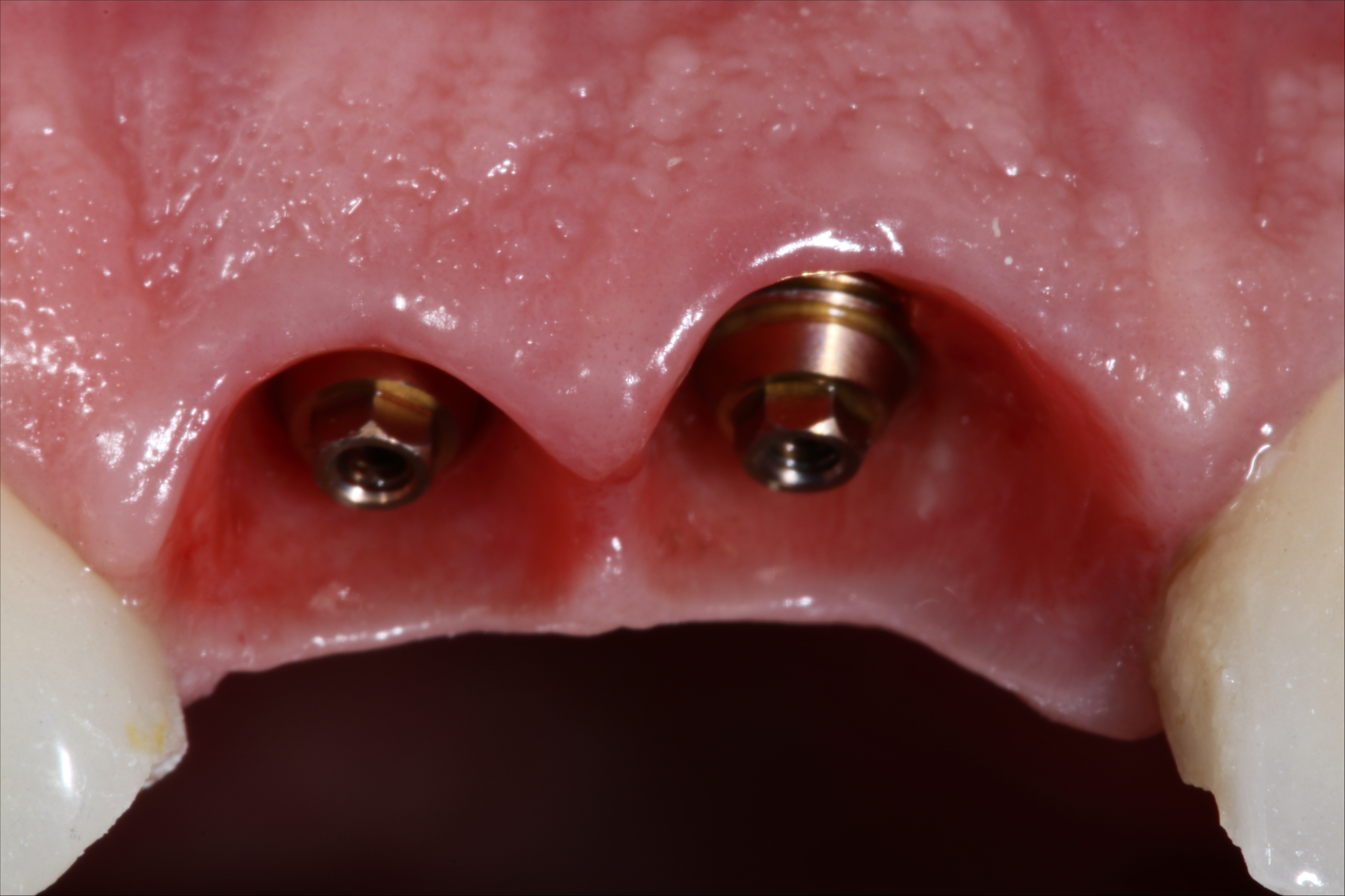 f José Leite 11 12 coloc (12).JPG