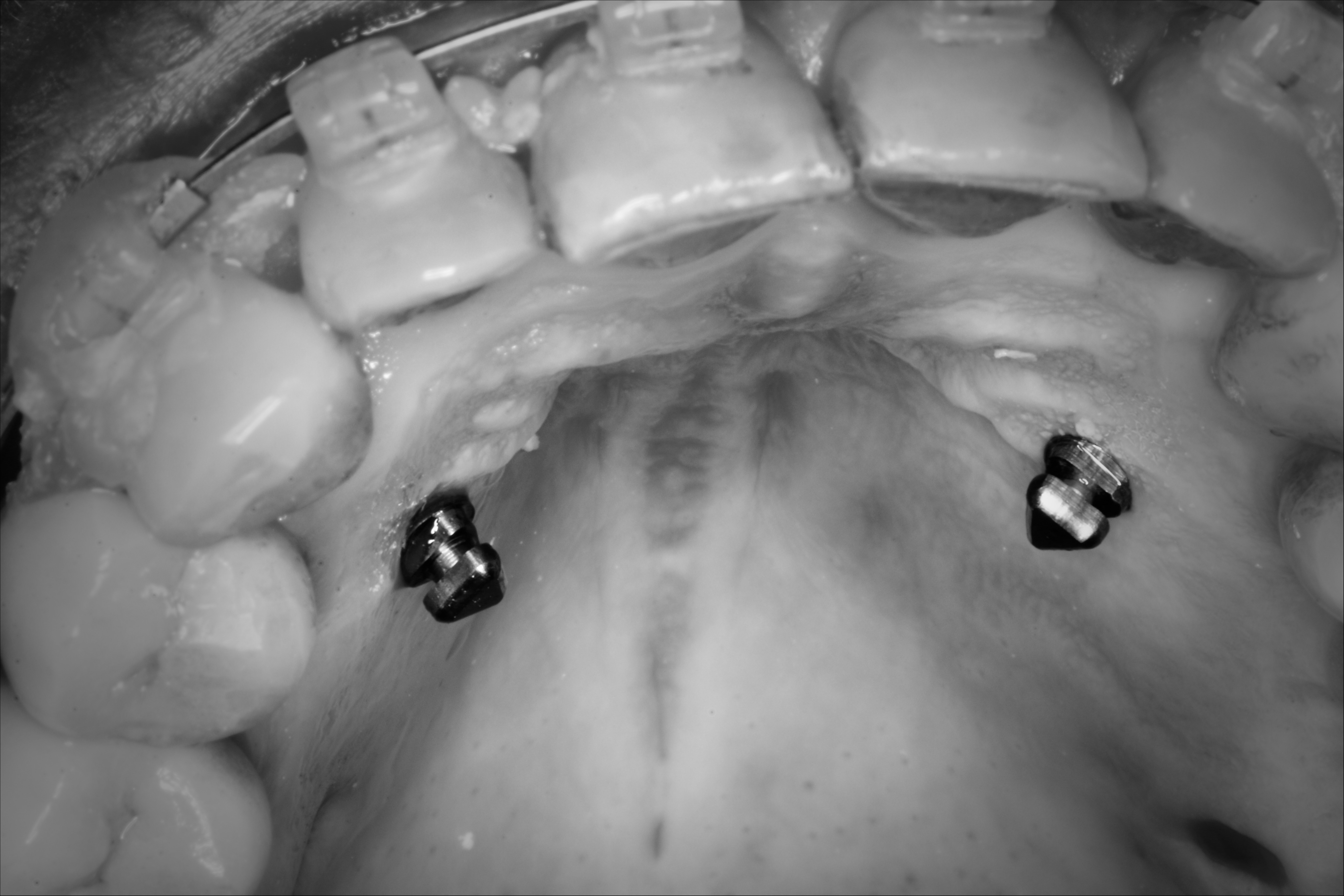 d Sameiro ortodontia (2).JPG